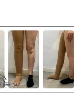 ~ Una media CCL3 de @medi.spain es una prenda de compresión de grado extra fuerte, diseñada para tratar afecciones venosas graves y proporcionar una compresión que oscila entre 33 y 46 mmHg.
~ Suelen ser opacas y resistentes.
~ A menudo cuentan con características para facilitar la colocación, como un diseño de talón en forma de “Y” o una banda de silicona superior para evitar que se deslicen.
~ Su composición es generalmente una mezcla de poliamida y elastano, siendo la versión CCL3 un 63% de poliamida y un 37% de elastano, según la línea del producto (ej. Mediven Plus).
#medi #mediascompresión #extrafuerte #medias #varices #trombosis #ulceras #enfermefadesvenosas #ortopediaespaña #expertosprotesica #prosthetics #ayudastecnicas #Ortoprotesico #Tecnicasrehabilitación #AyudasRehabilitacion #mobiliarioadaptado #ortopediafuncional #ortopediamadrid #SillasDeRuedas #LibertadDeMovimiento #CuidadoDeLaSalud #ortopedia #promociones #ofertas #ortopediamedica #leganes #madrid #salud #ortopediamuñoz